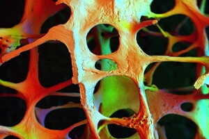 Stärkung der Knochen durch Immunzellen