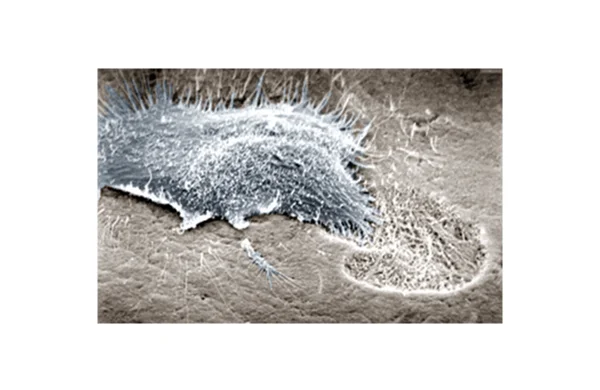 Knochenumbau Osteoklasten Knochenresorption