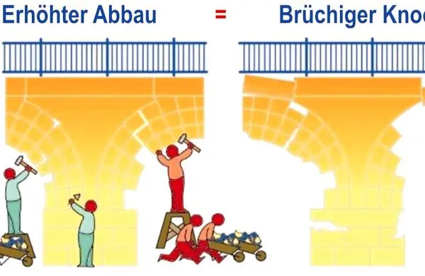 osteoporose_knochenabbau.jpg