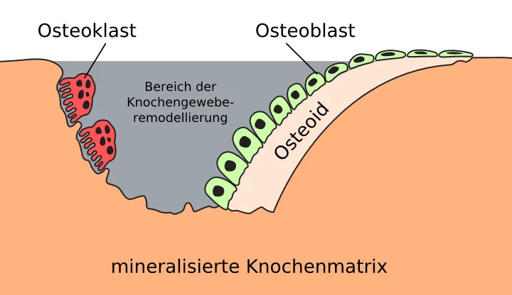 Knochenumbau Knochenumbau
